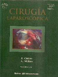 Cirugia Laparoscopica