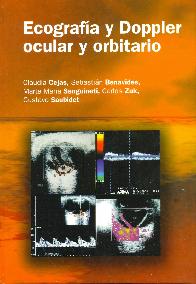 Ecografia y Doppler ocular y orbitario