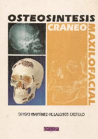 Osteosintesis craneomaxilofacial