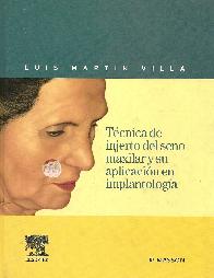 Tecnica del injerto de seno maxilar y su aplicacion en implantologia