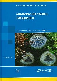 Sndrome del Ovario Poliqustico
