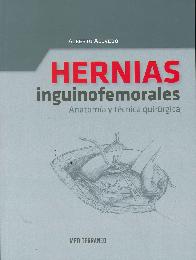 Hernias Inguinofemorales