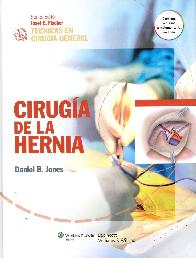 Ciruga de la Hernia