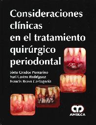 Consideraciones cl�nicas en el tratamiento quir�rgico periodontal