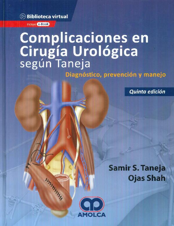 Complicaciones en Cirugía Urológica según Taneja