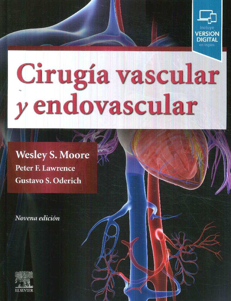 Ciruga Vascular y Endovascular