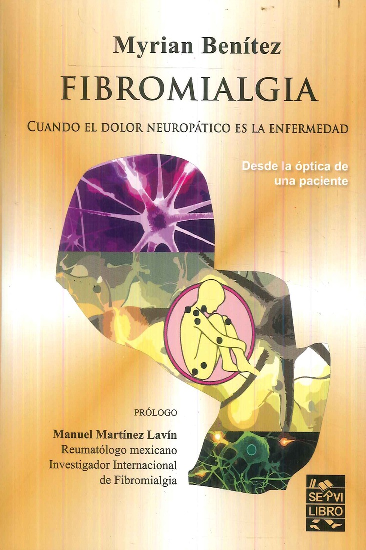 Fibromialgia  Desde la óptica de una paciente