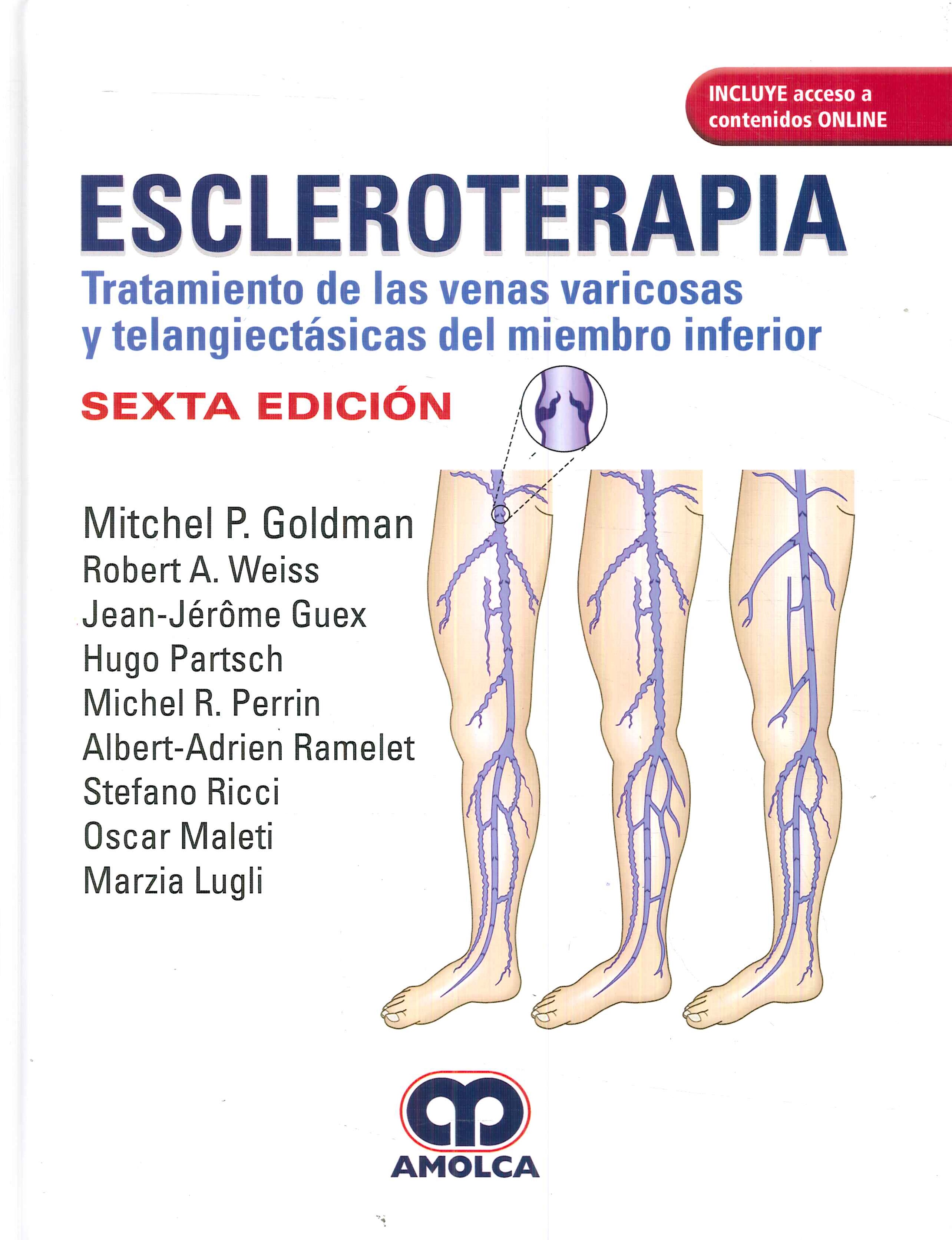 Escleroterapia