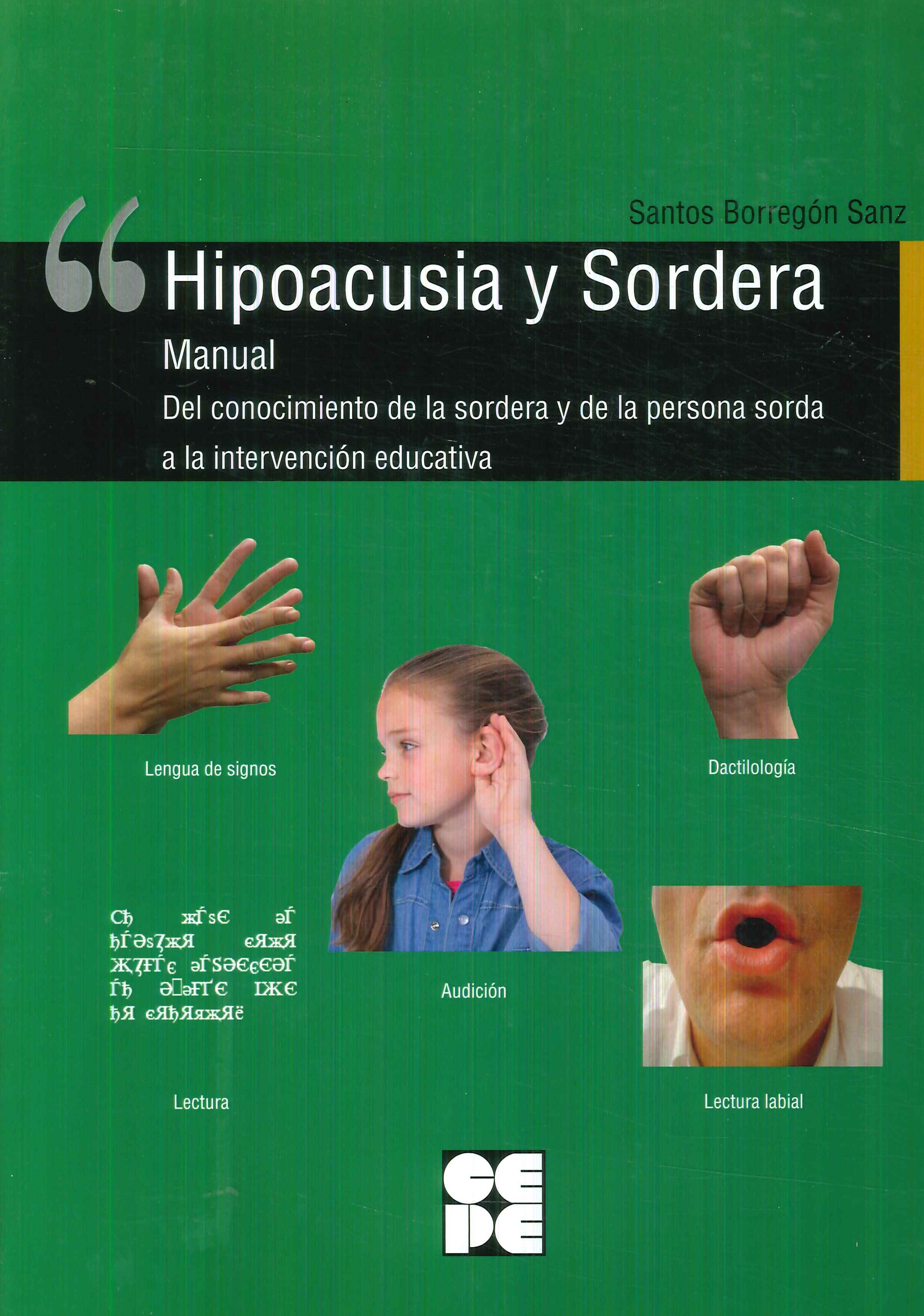 Hipoacusia y Sordera Manual
