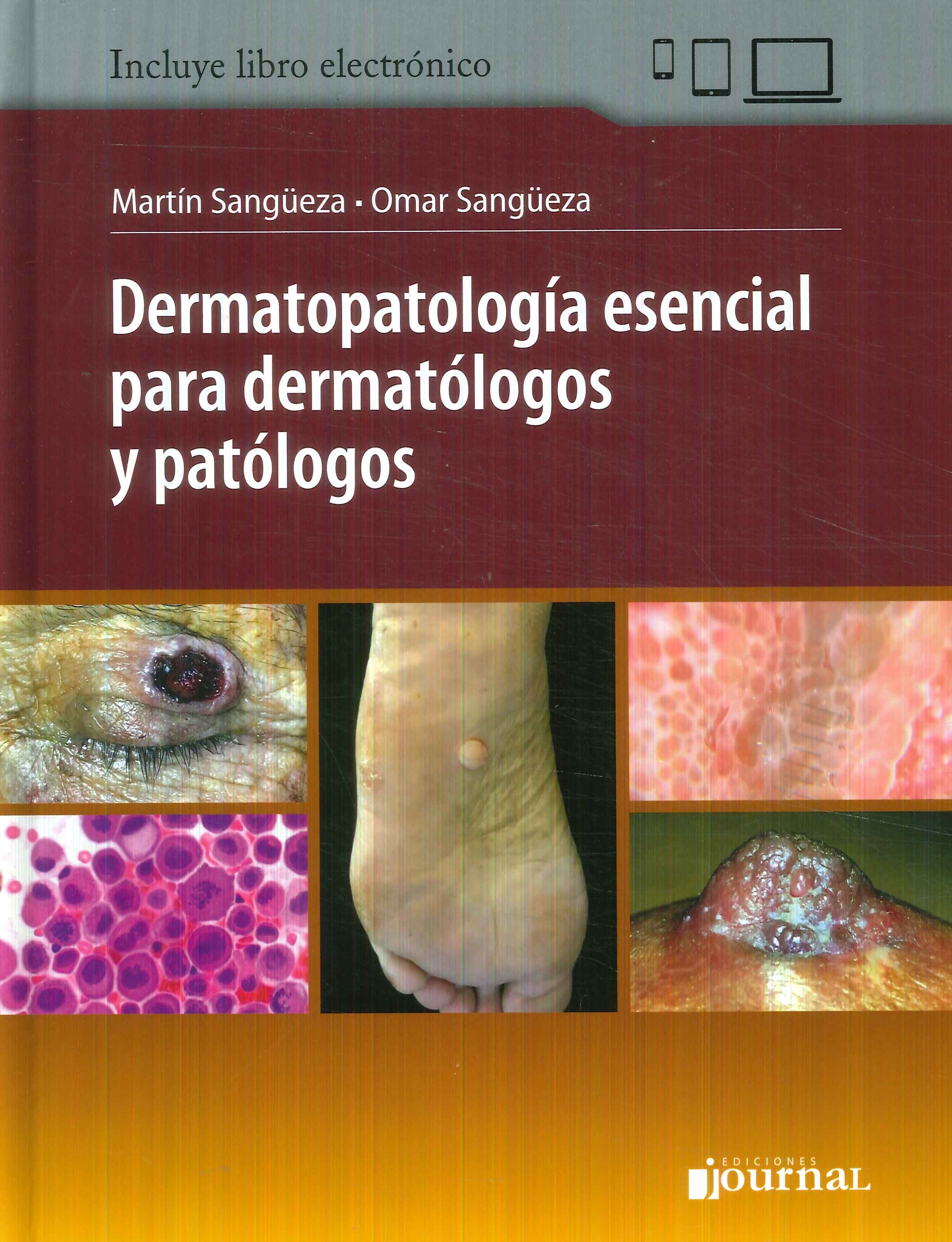 Dermatopatolog�a esencial para dermat�logos y pat�logos
