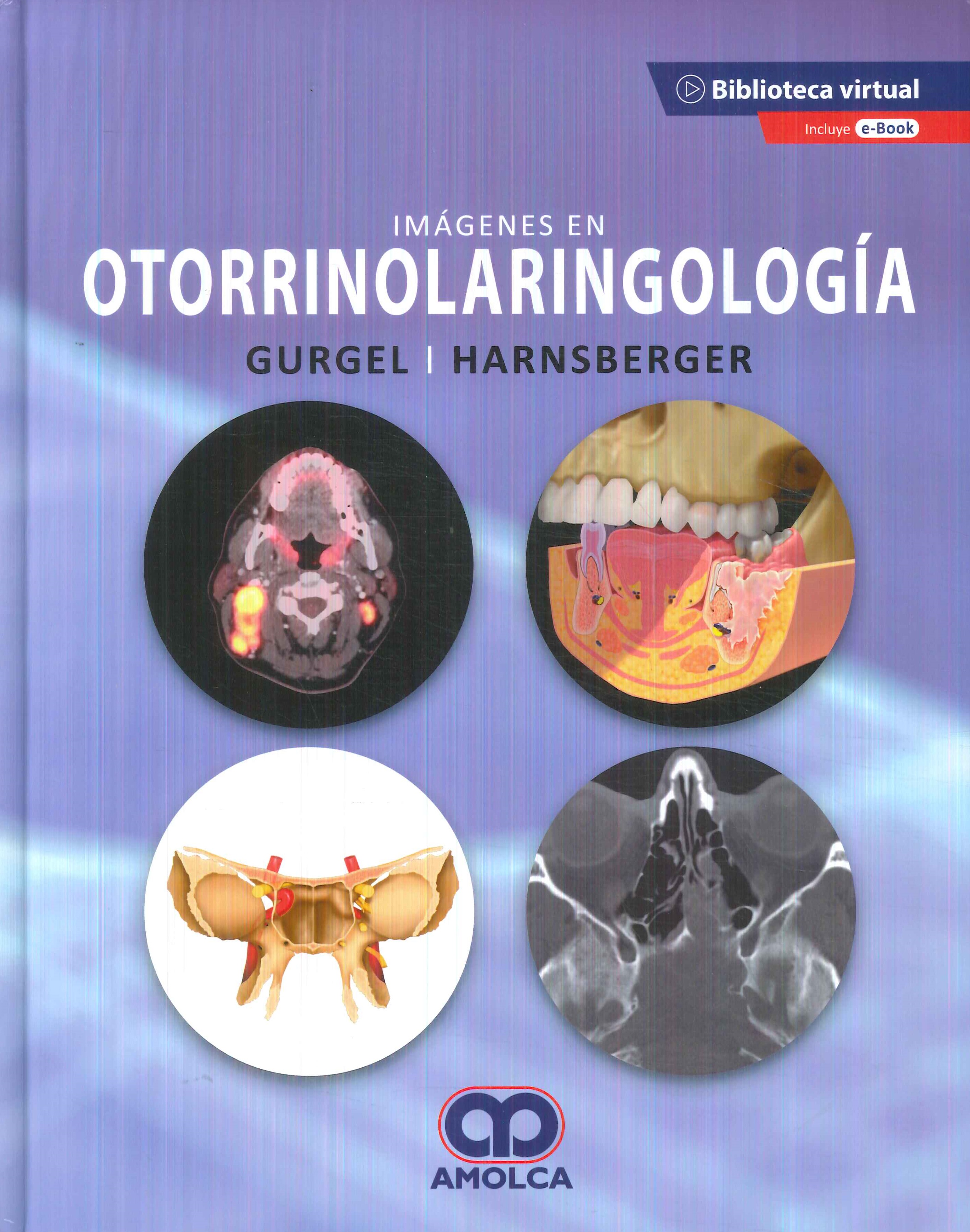 Im�genes en Otorrinolaringolog�a