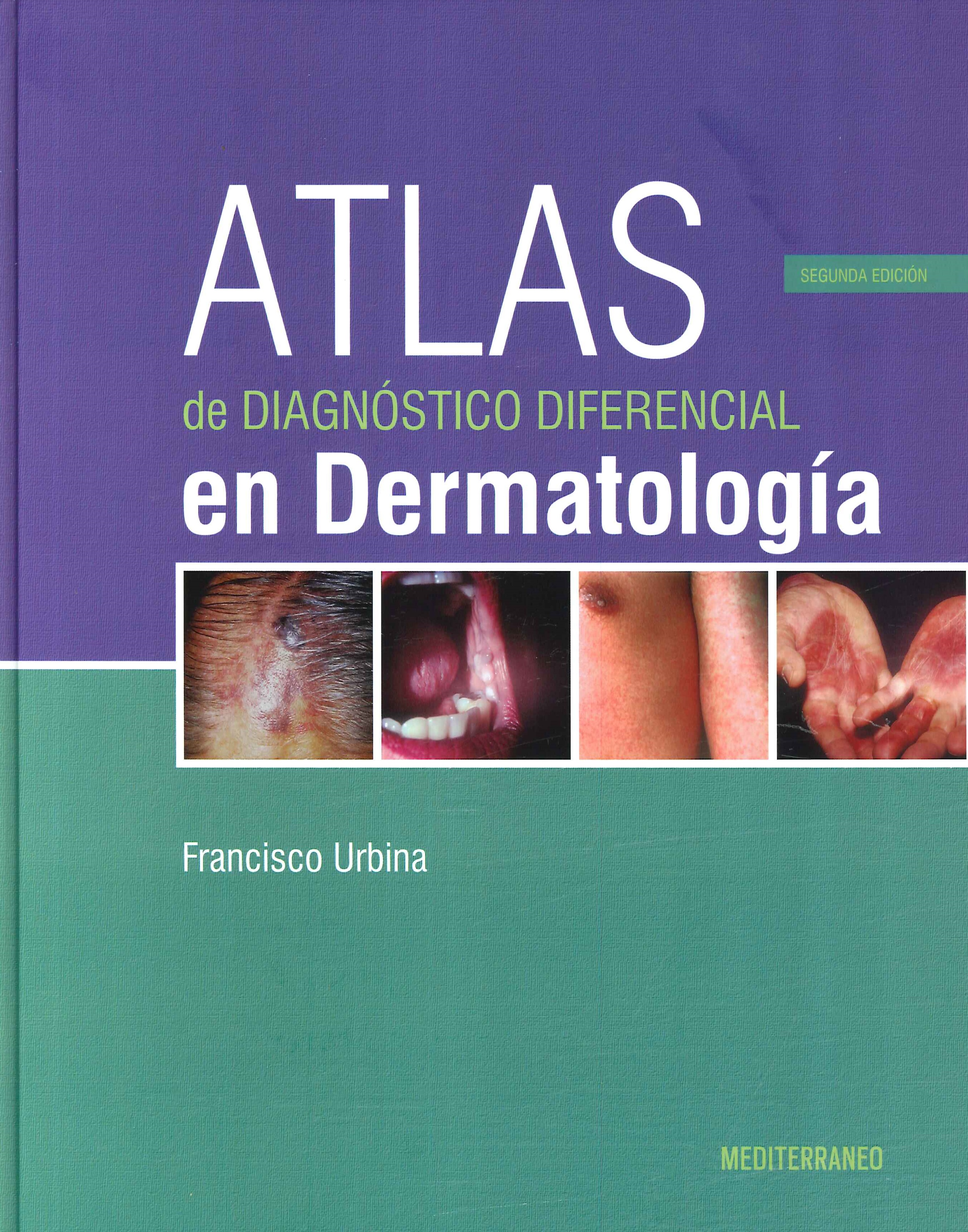 Atlas de Diagnstico Diferencial en Dermatologa
