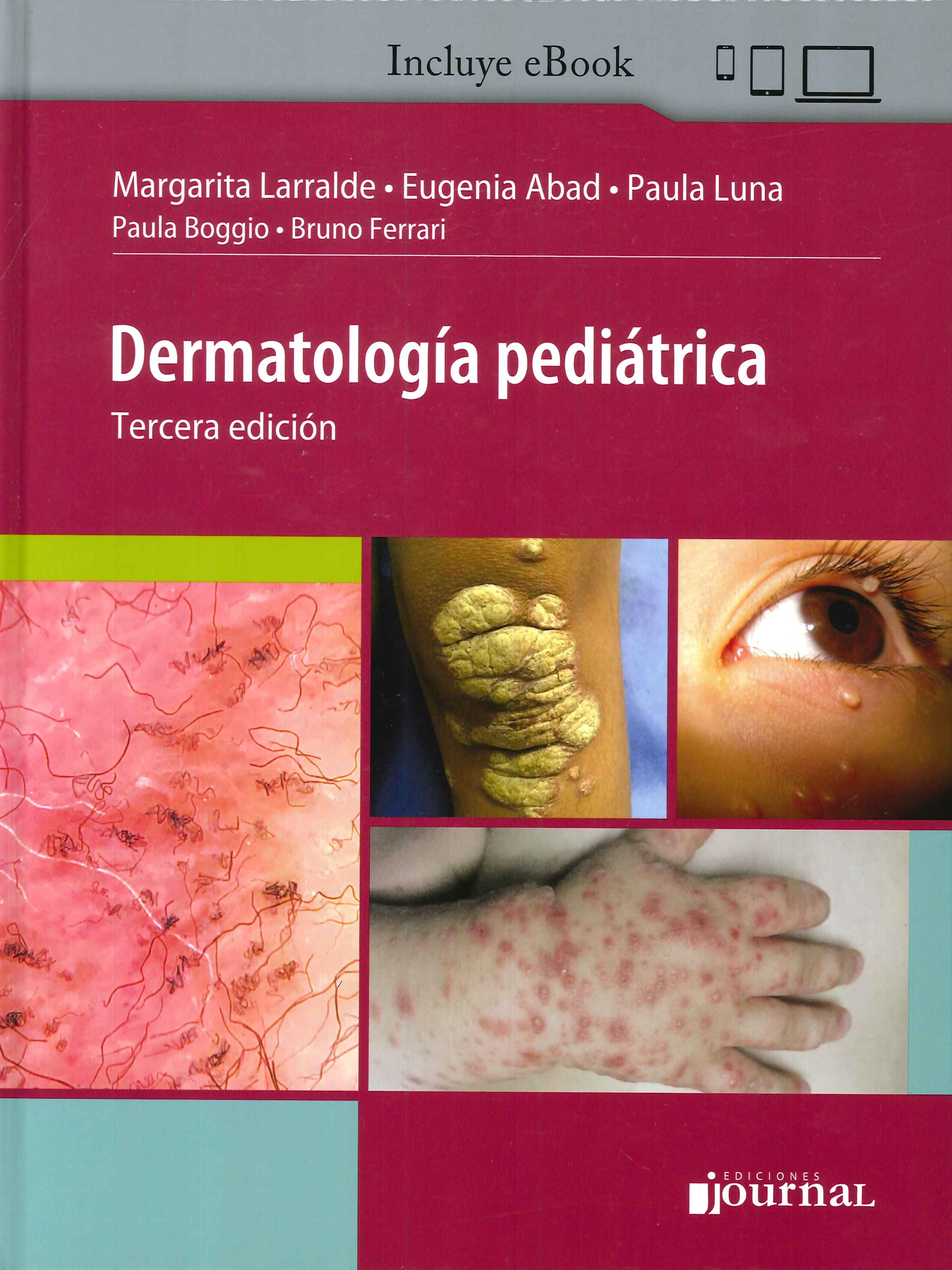 Dermatología Pediátrica