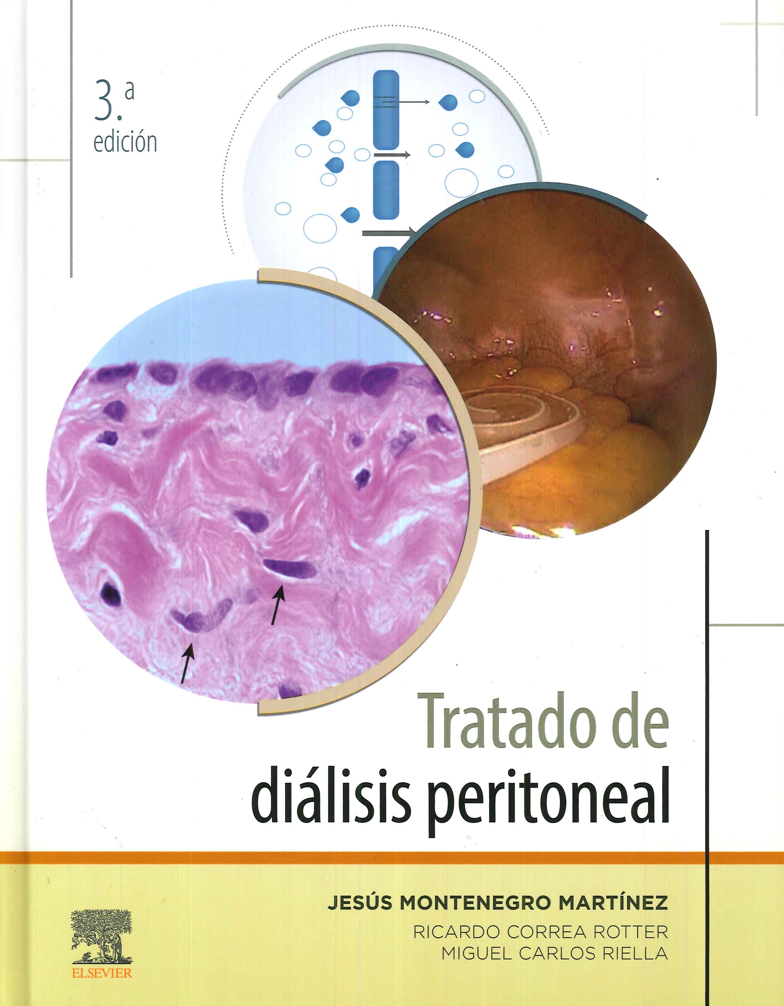 Tratado de di�lisis peritoneal