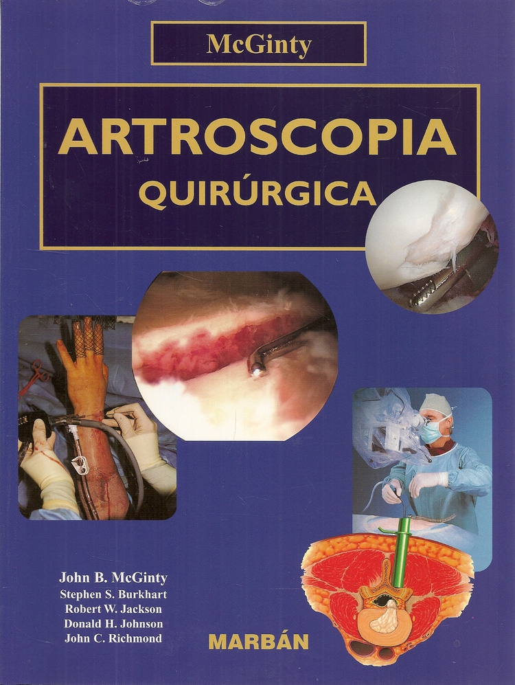 Artroscopia quirugica