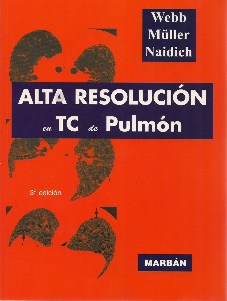 Alta resolución en TC de Pulmón