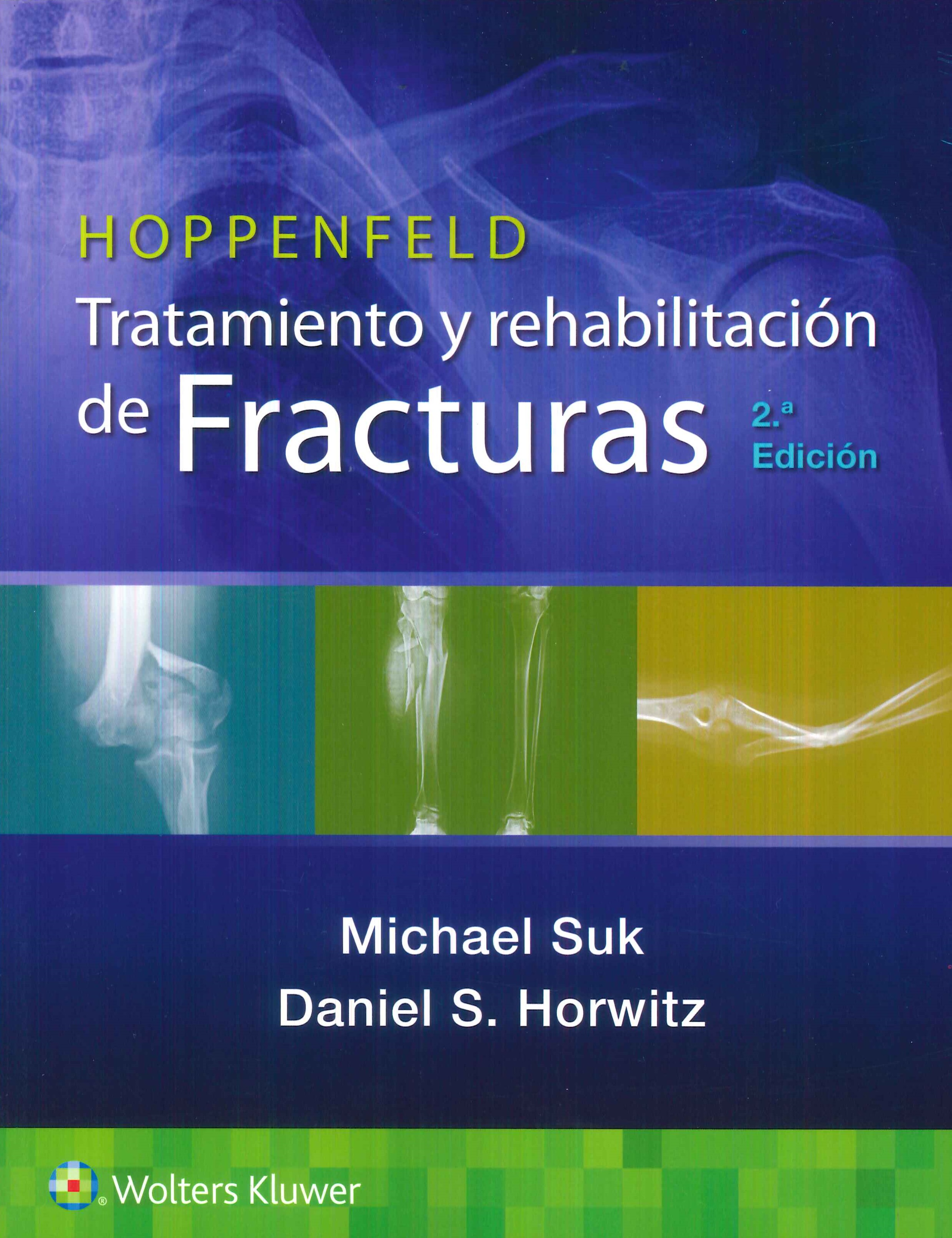 Hoppenfeld. Tratamiento y rehabilitación de fracturas