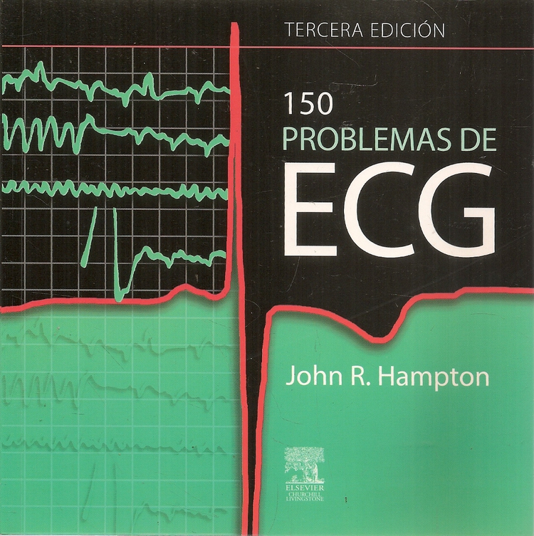 150 problemas de ECG