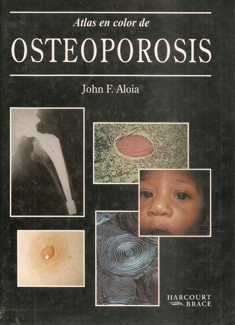 Atlas en color de osteoporosis