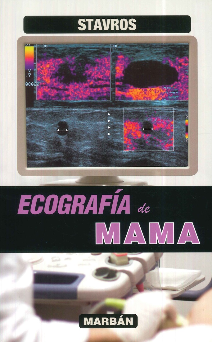 Ecograf�a de Mama Stavros