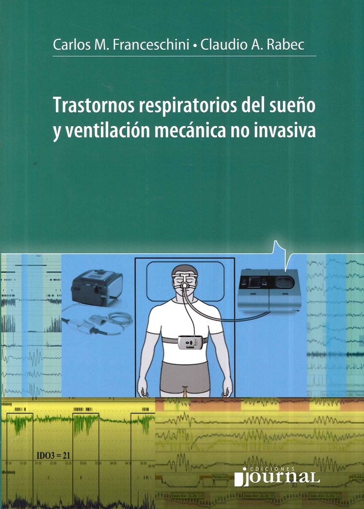 Trastornos Respiratorios del Sueo y Ventilacin Mecnica No Invasiva