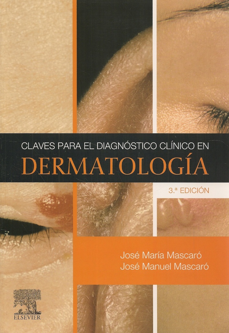 Claves para el diagnostico clinico en Dermatologia