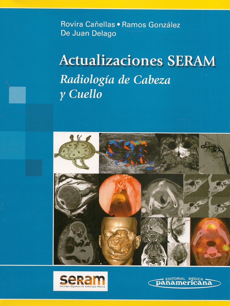 Actualizaciones SERAM Radiolg�a de cabeza y cuello