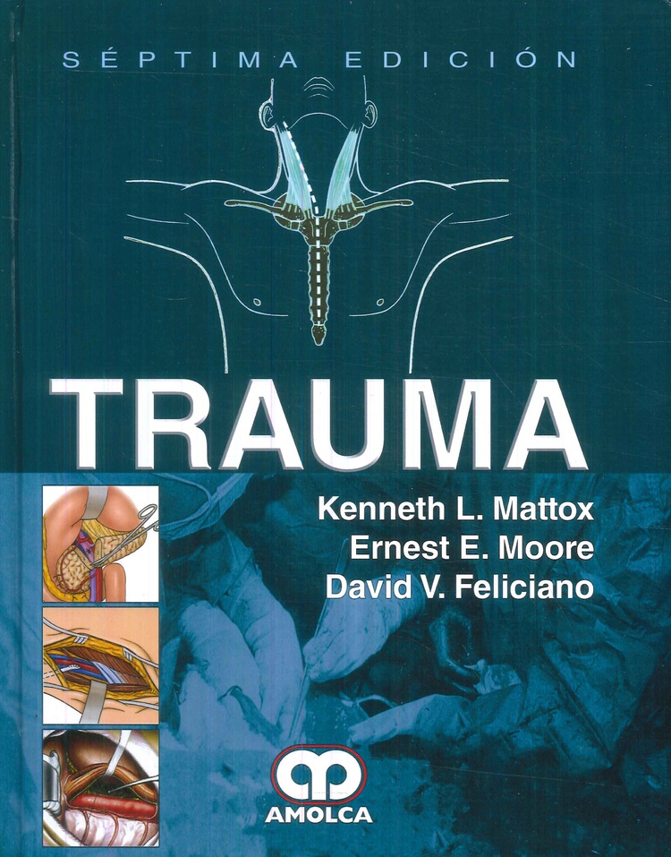 Trauma