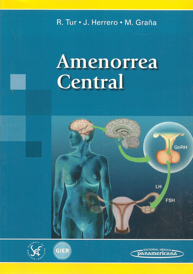 Amenorrea Central