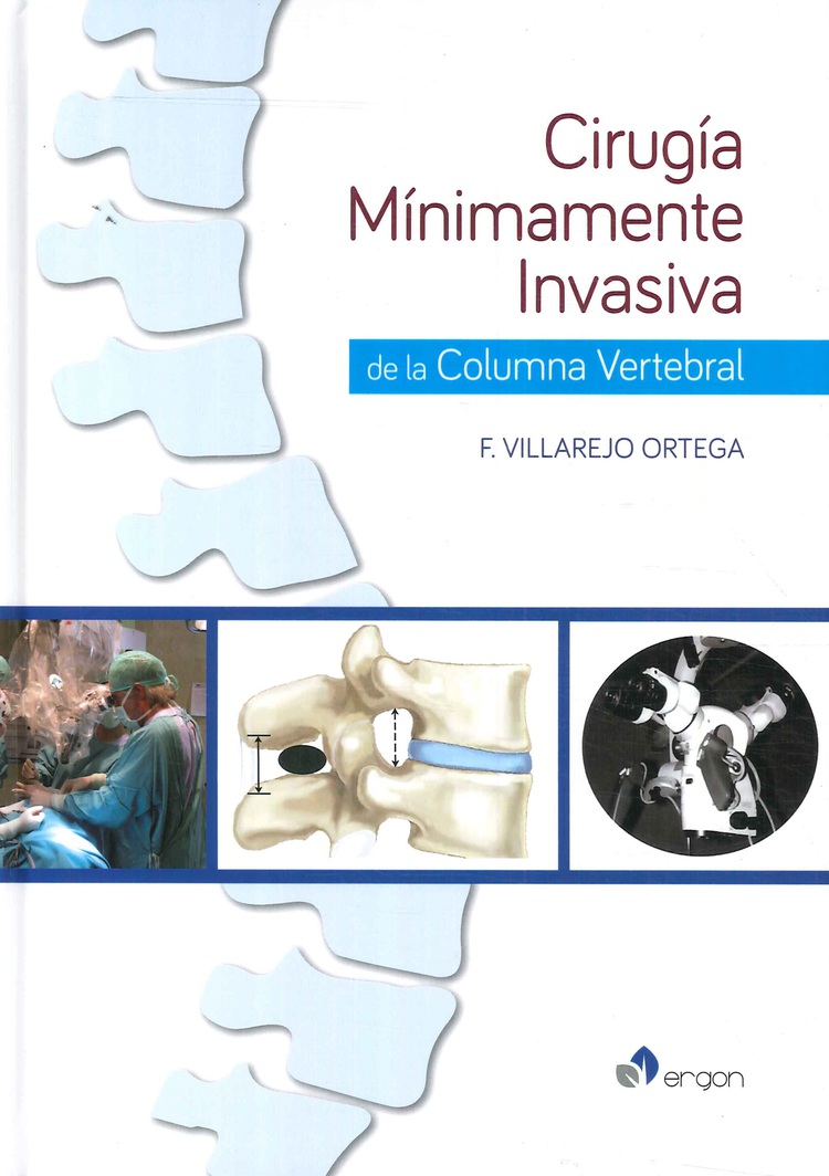 Cirug�a M�nimamente Invasiva de la Columna Vertebral