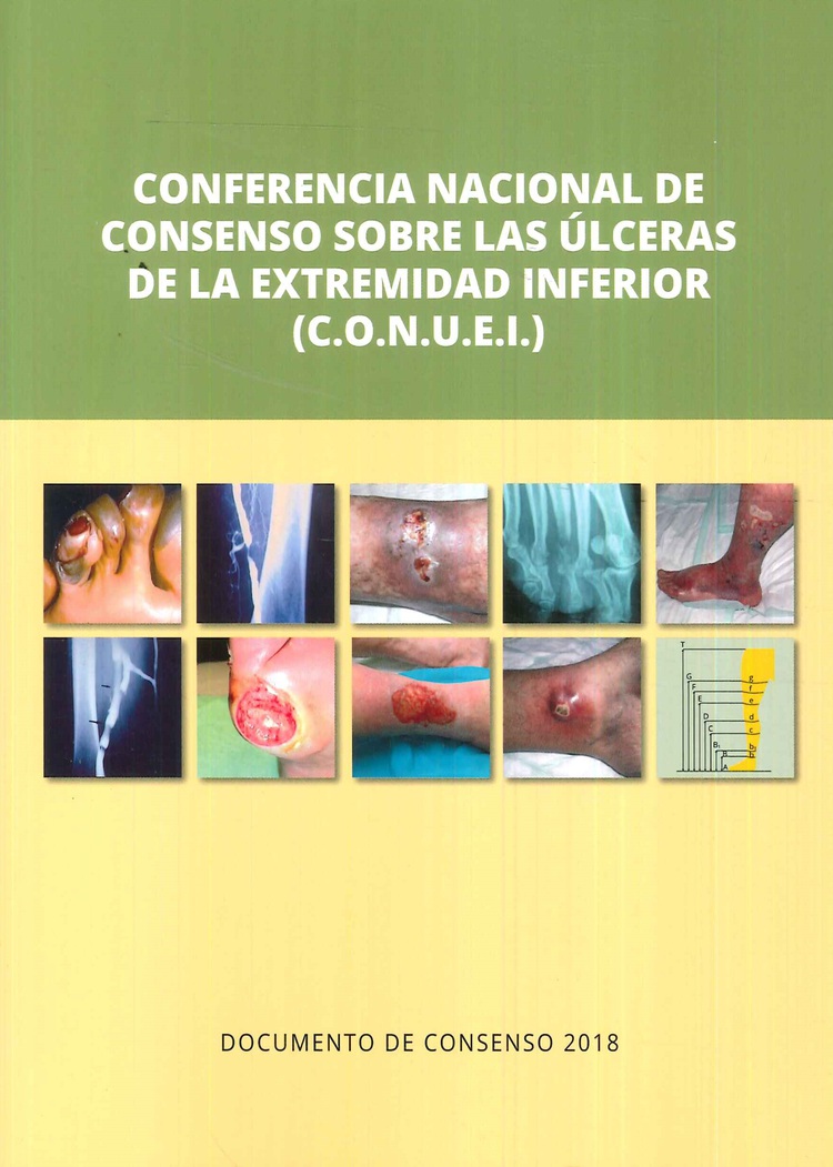Conferencia nacional de consenso sobre las lceras de la extremidad superior