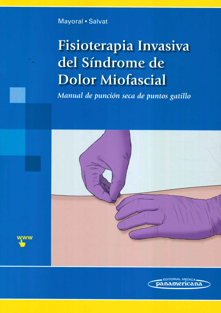 Fisioterapia Invasiva del S�ndrome de Dolor Miofascial