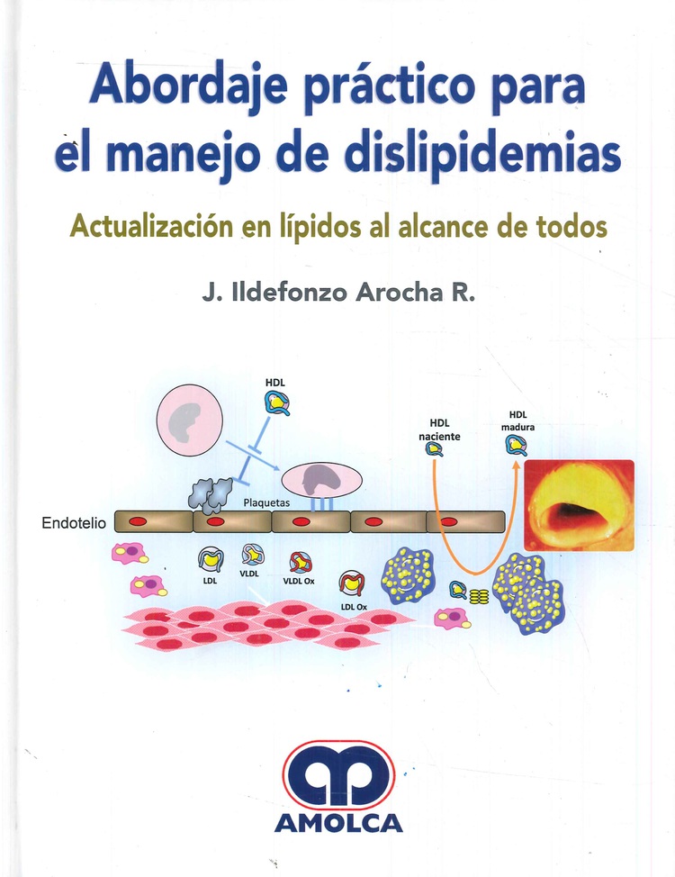 Abordaje prctico para el manejo de dislipidemias
