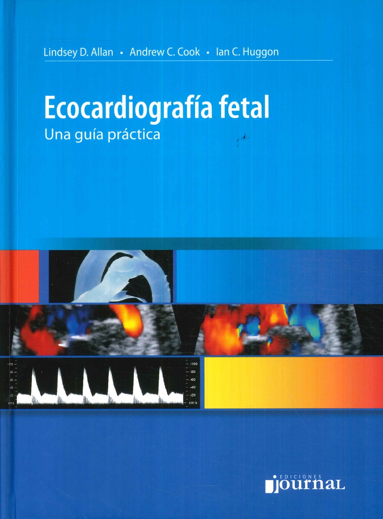 Ecocardiografa Fetal
