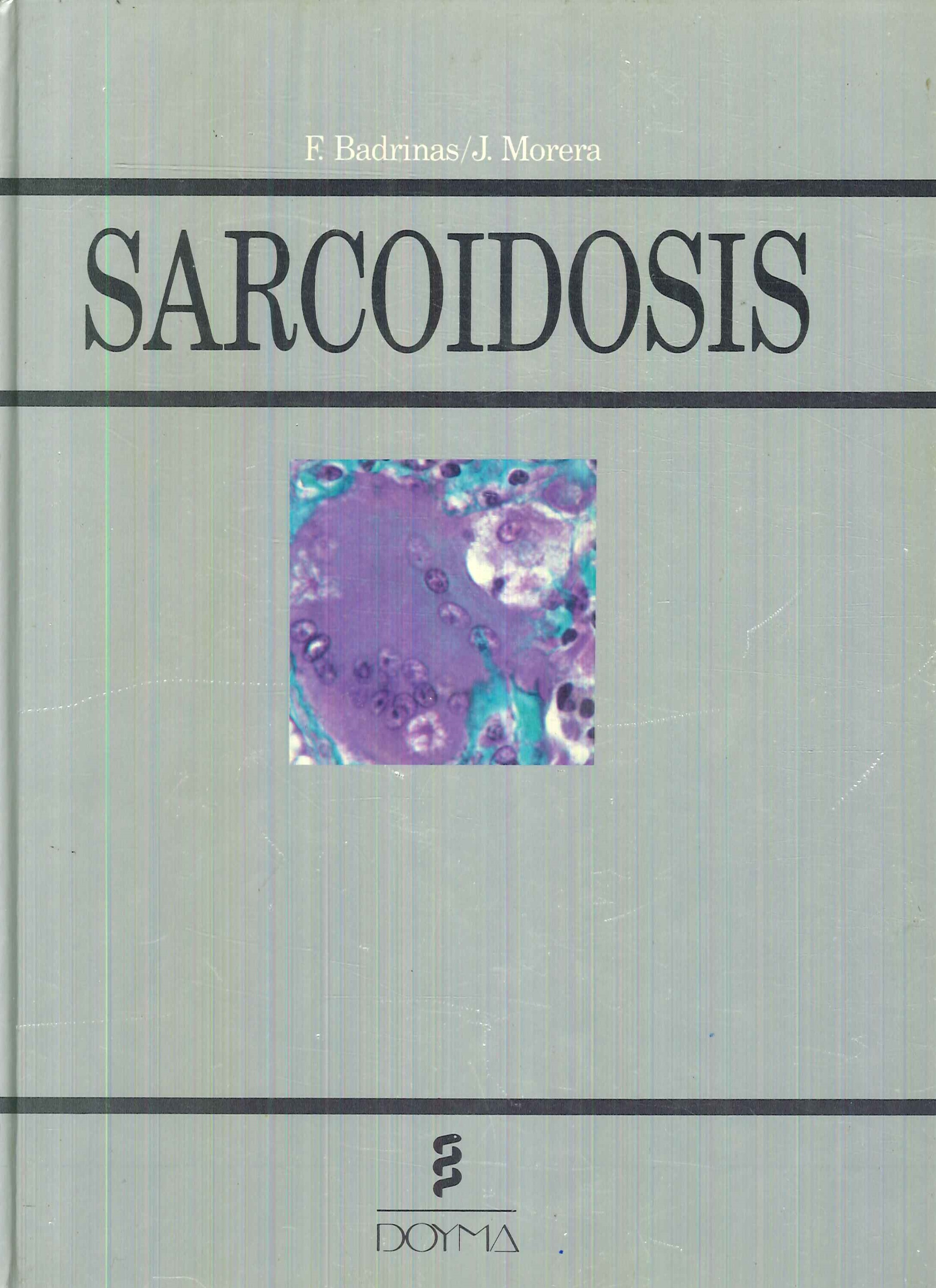 Sarcoidosis