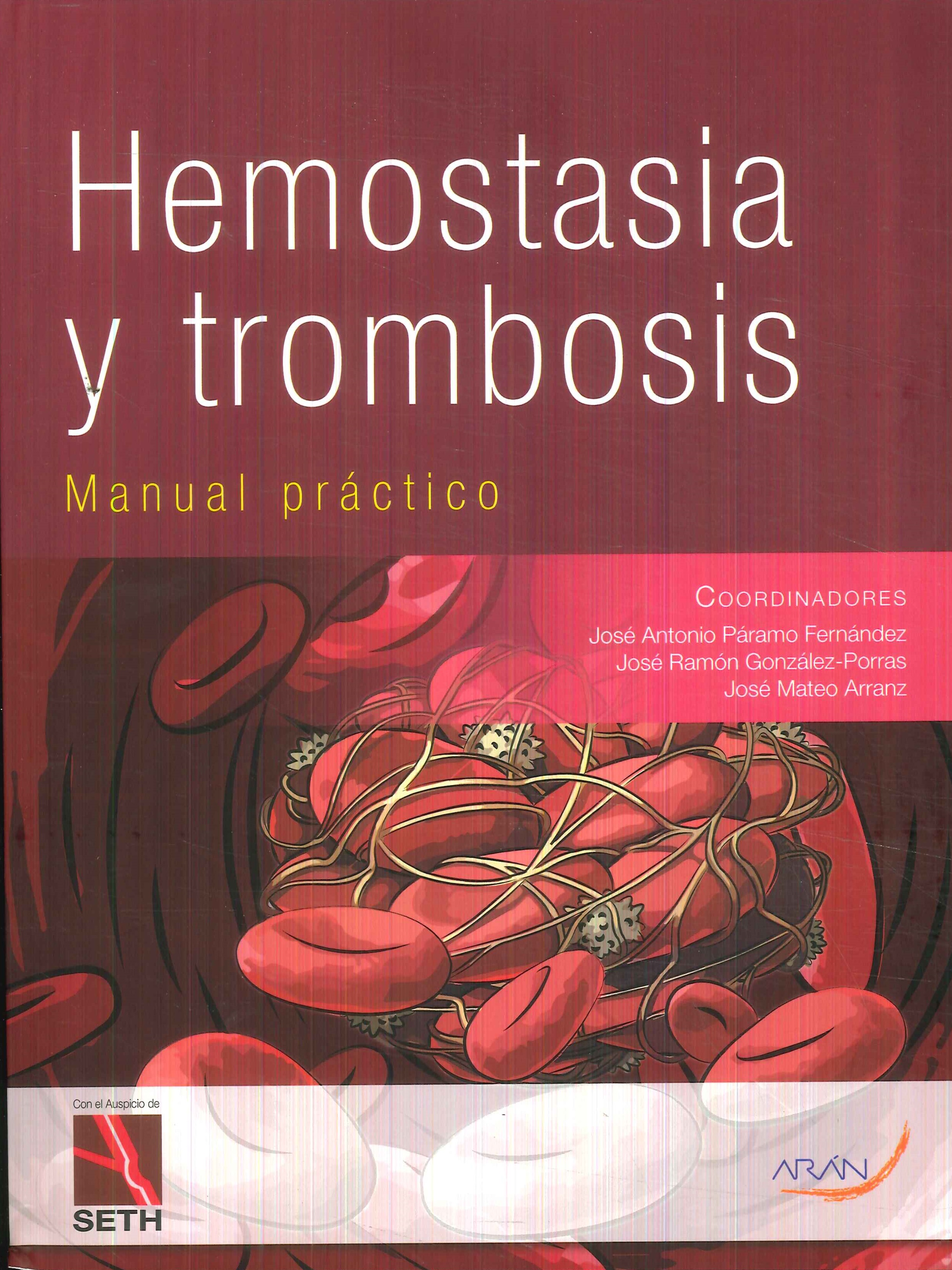 Hemostasia y trombosis