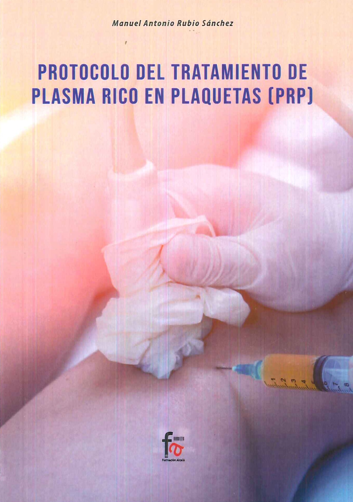 Protocolo del tratamiento de plasma rico en plaquetas (PRP)