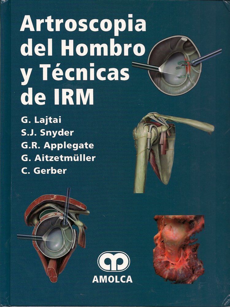 Artroscopia del Hombro y T�cnicas de IRM