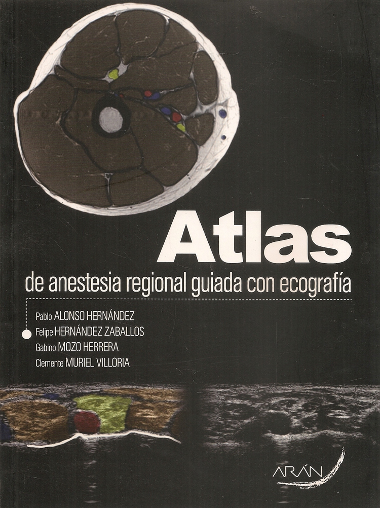 Atlas de anestesia regional guiada con ecografa
