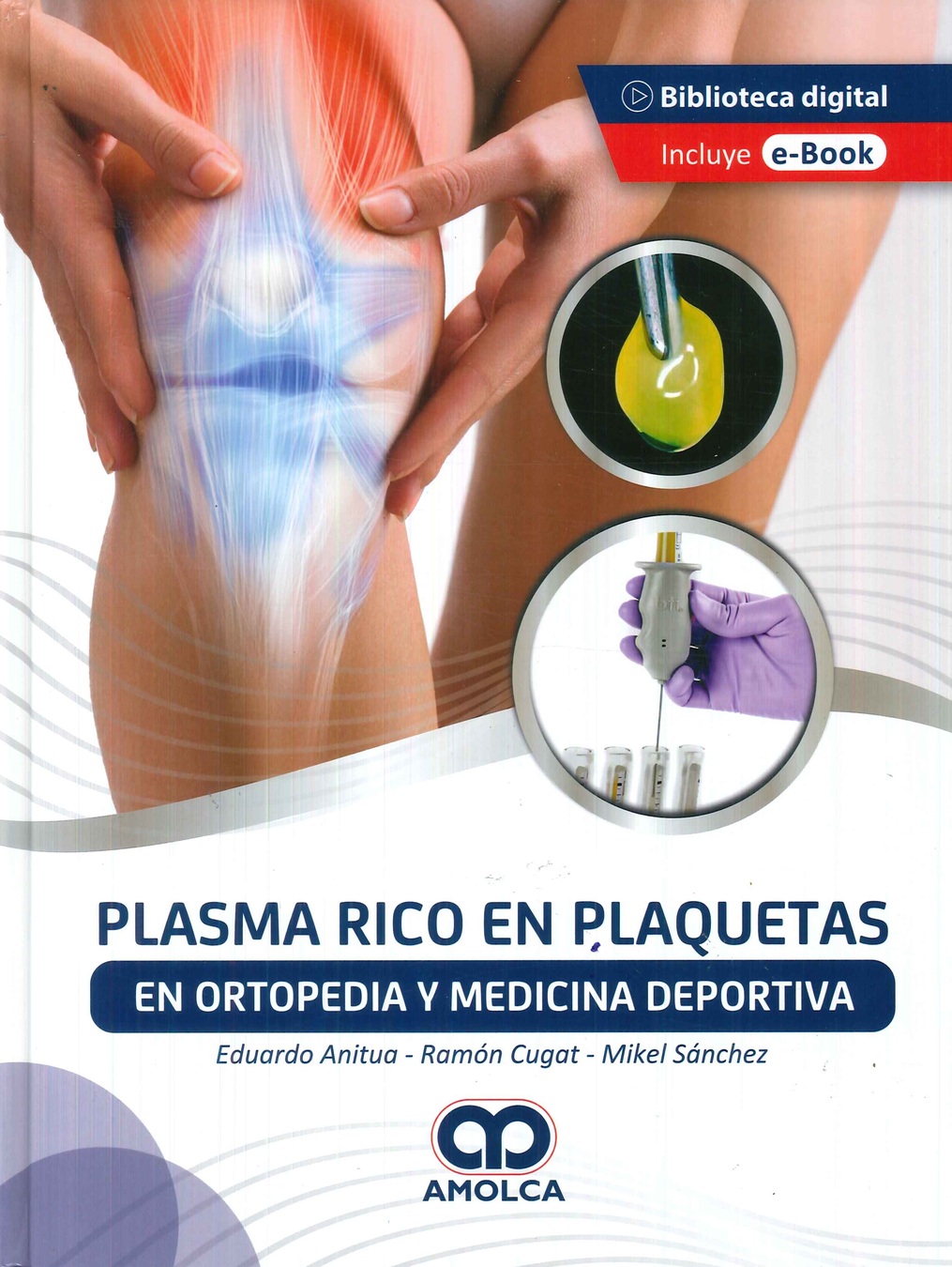 Plasma rico en plaquetas en ortopedia y medicina deportiva