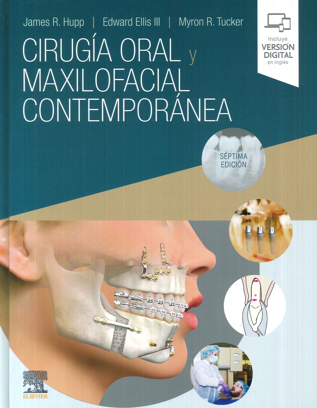 Cirug�a oral  y maxilofacial contempor�nea