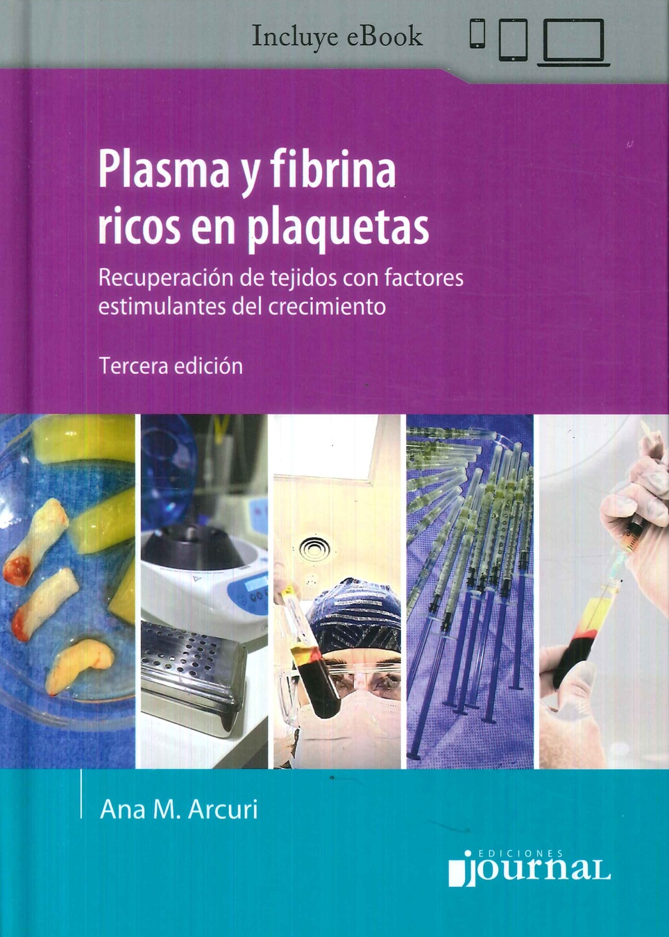 Plasma y fibrina ricos en plaquetas