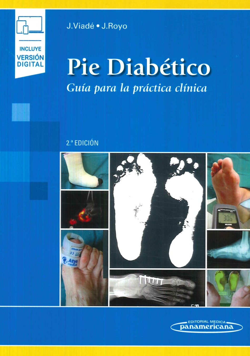 Pie diab�tico. Gu�a para la pr�ctica cl�nica