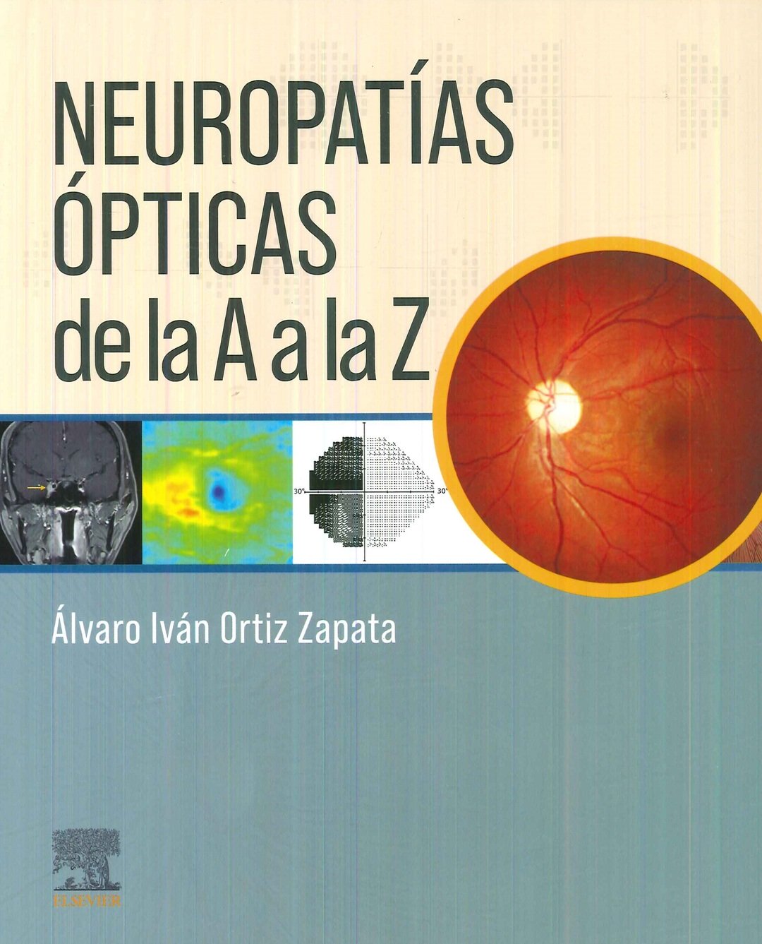 Neuropat�as �pticas de la A a la Z