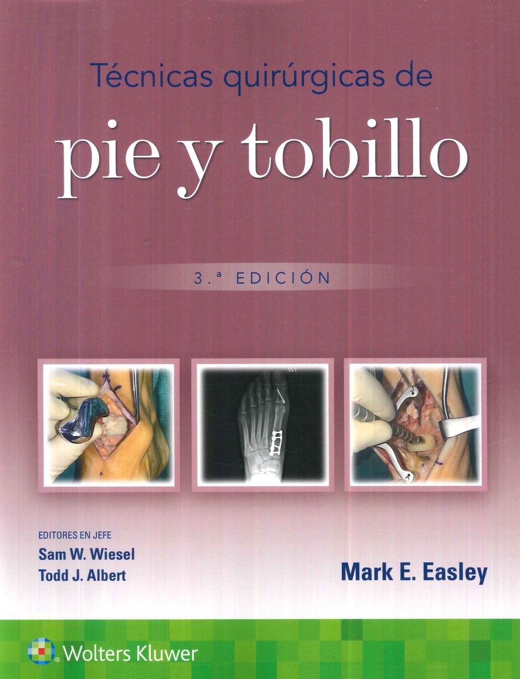 T�cnicas quir�rgicas de pie y tobillo