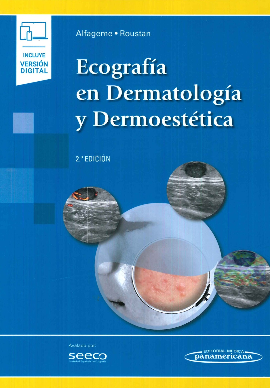 Ecografa en dermatologa y dermoesttica