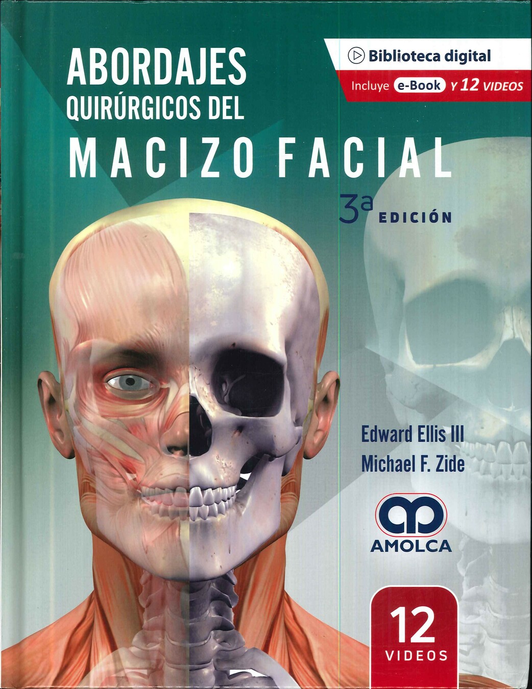 Abordajes quirrgicos del macizo facial