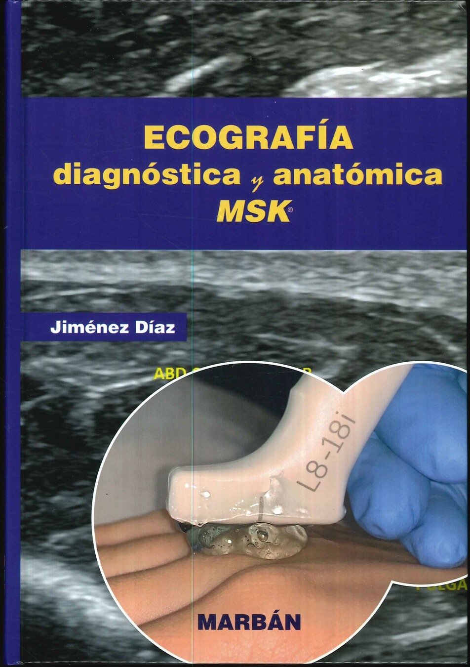 Ecografa diagnstica y anatmica MSK
