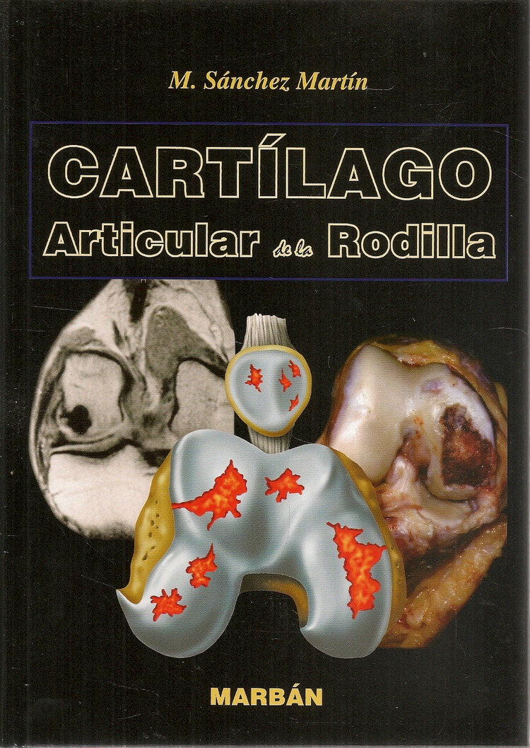 Cart�lago articular de la rodilla
