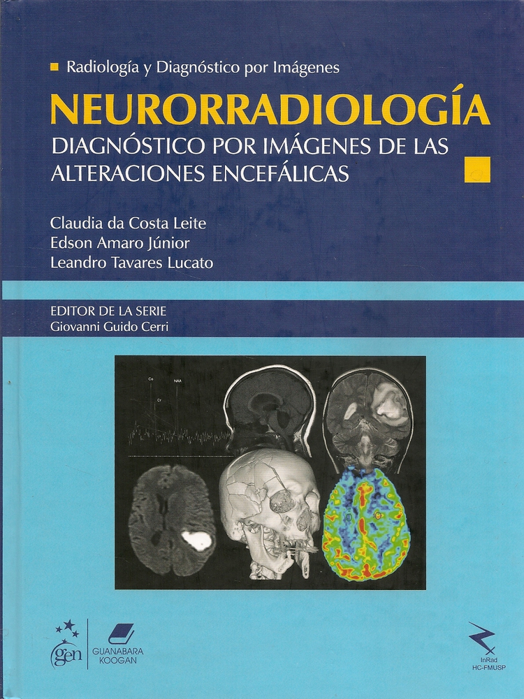 Neurorradiologa. Radiologa y diagnstico por imgenes